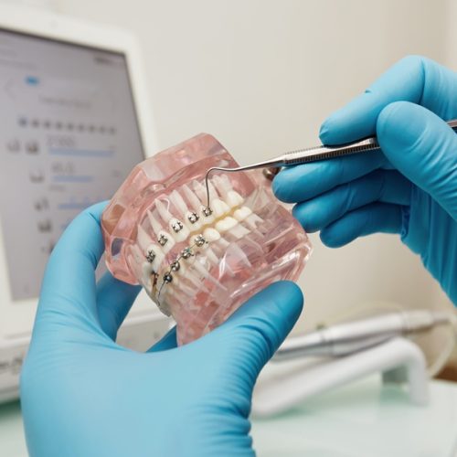 A confident smile begins with the right care! Discover personalized orthodontic treatments at Dr. Panjiar’s Multispeciality Dental Centre — the best dental centre in Hadapsar.